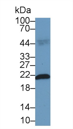 13238