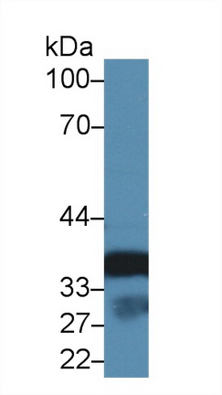 14145