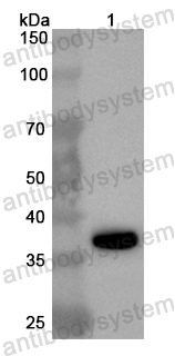 Валидация AntibodySystem PHB84401