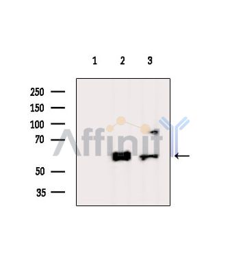 Валидация Affinity DF15651 - 12084