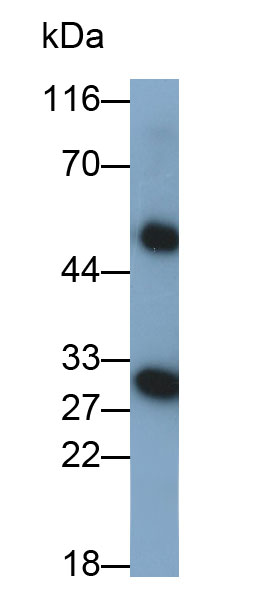 55523