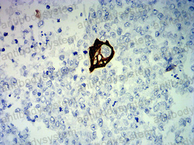 Валидация AntibodySystem RHC99403 (1243)
