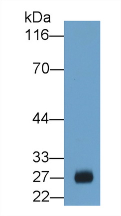 26087