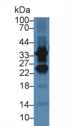 13913