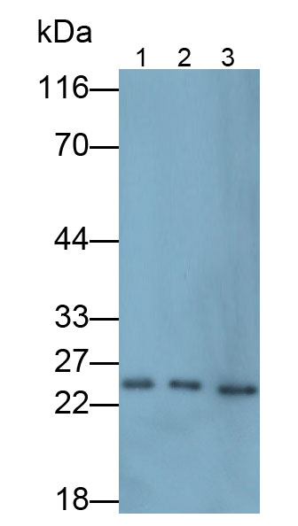30869