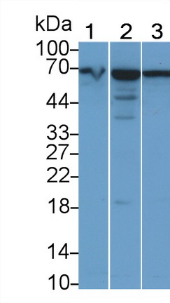 20615
