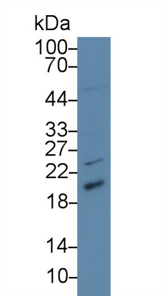 13935
