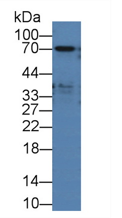 11969
