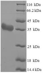 SDS-PAGE