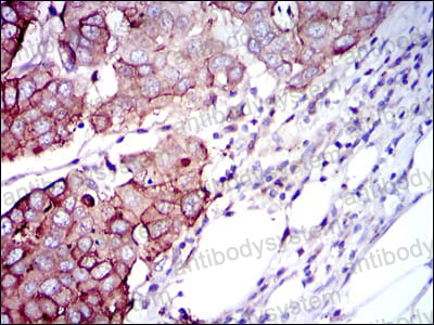 Валидация AntibodySystem RHD57803 (1654)