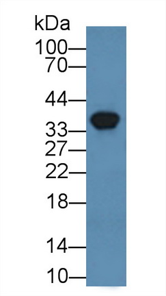 12357