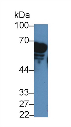 12867