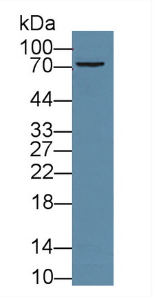 11970