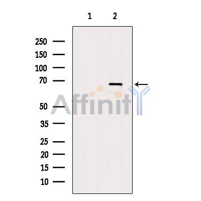 Валидация Affinity DF6875 - 18463