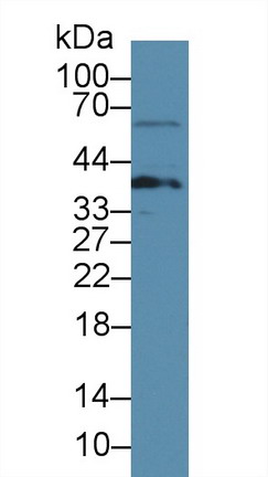 8395