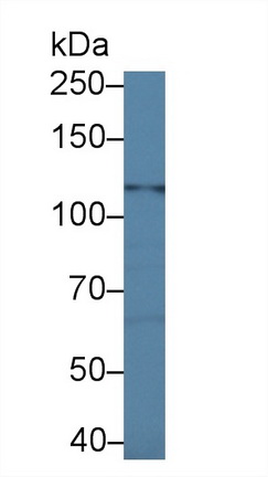 14371