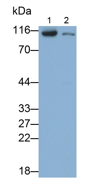 32535