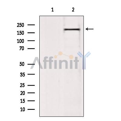 Валидация Affinity DF3858 - 14996