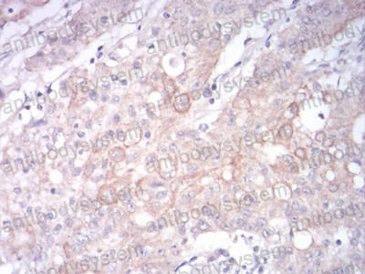 Валидация AntibodySystem RHG14203