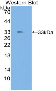 56141