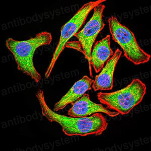 Валидация IF - AntibodySystem RHJ80804 (1454)