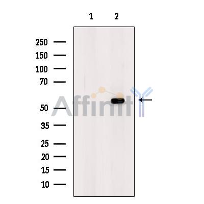 Валидация Affinity DF4355 - 15811