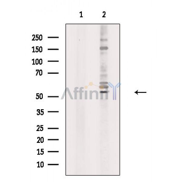 Валидация Affinity DF7241 - 18891