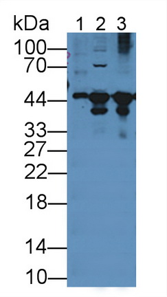 12011