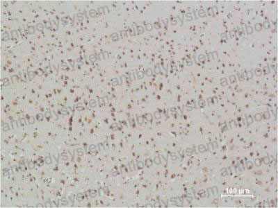 Валидация AntibodySystem RHG01007