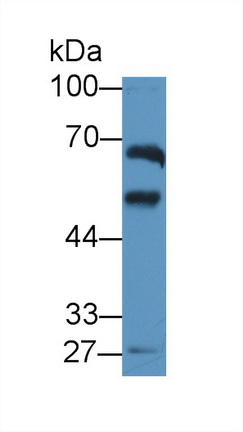 14151