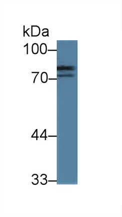 14291