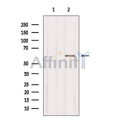 Валидация Affinity AF6035 - 3237