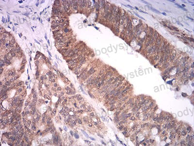 Валидация AntibodySystem RHK65804