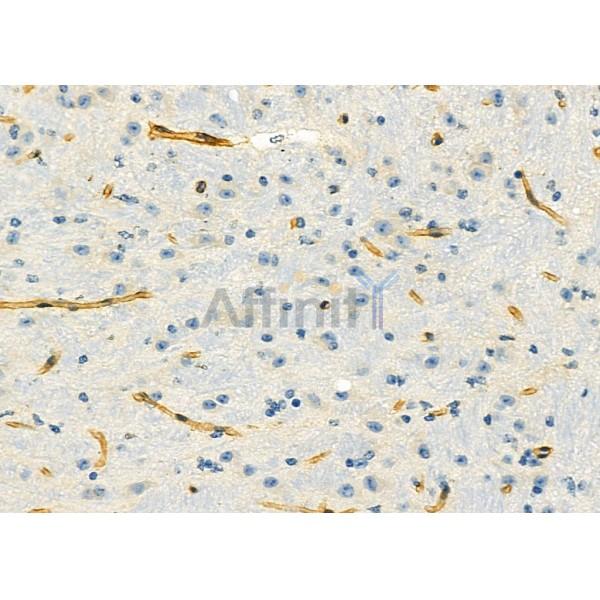 Валидация Affinity DF3687 - 14707