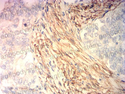 Валидация AntibodySystem RHH09402 (3171)