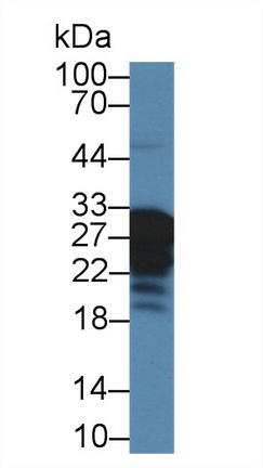 14479