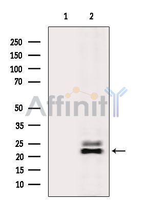 Валидация Affinity DF9552 - 22213
