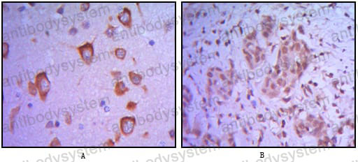 Валидация AntibodySystem RHD07703