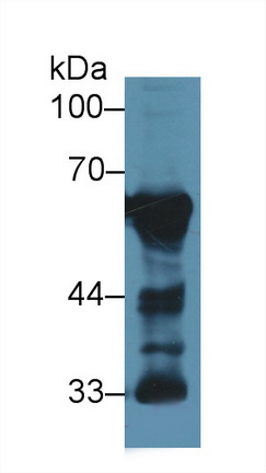 13539