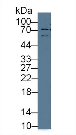 14279