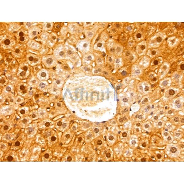 Валидация Affinity DF13036 - 7866