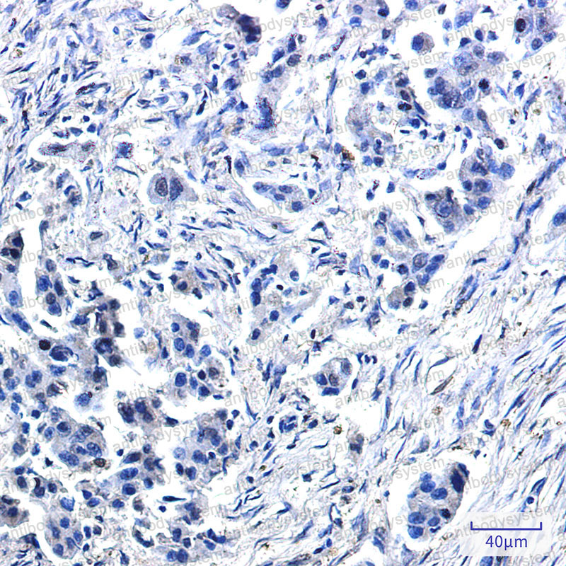 Валидация AntibodySystem RHG87901