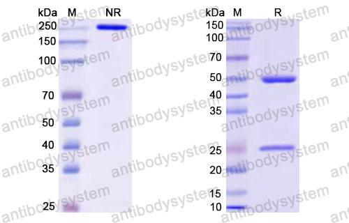 Валидация SDS-PAGE - AntibodySystem RMJ92801