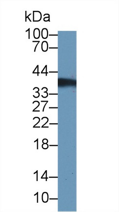 14473