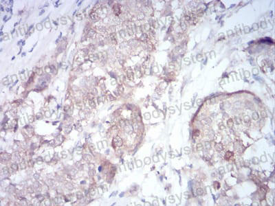 Валидация AntibodySystem RHF45202