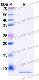EHG85101, SDS-PAGE
