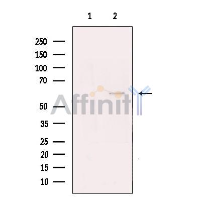 Валидация Affinity DF13426 - 8735