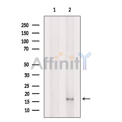 Валидация Affinity DF12038 - 6074