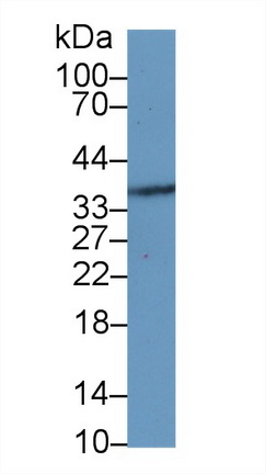 14169