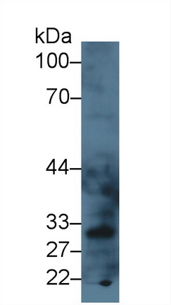 9382